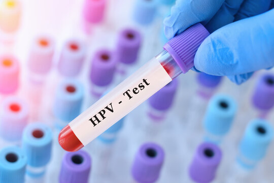 ویروس اچ پی وی چگونه منتقل می شود