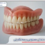 هزینه دندان مصنوعی بیمه تکمیلی